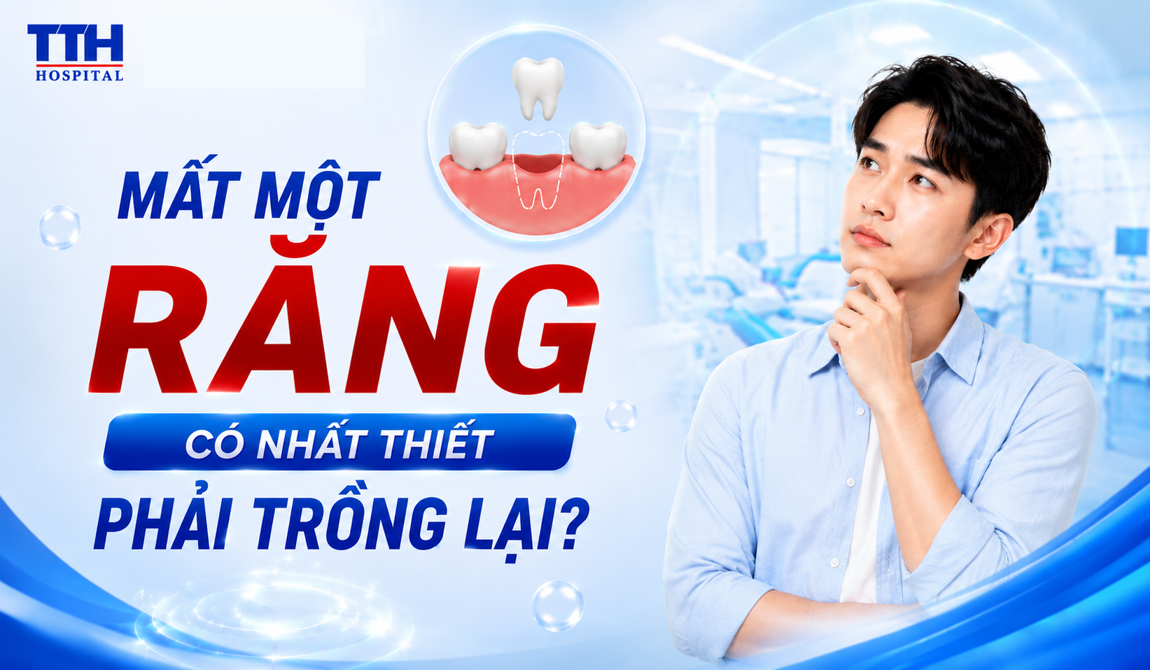 MẤT MỘT RĂNG CÓ NHẤT THIẾT PHẢI TRỒNG LẠI?